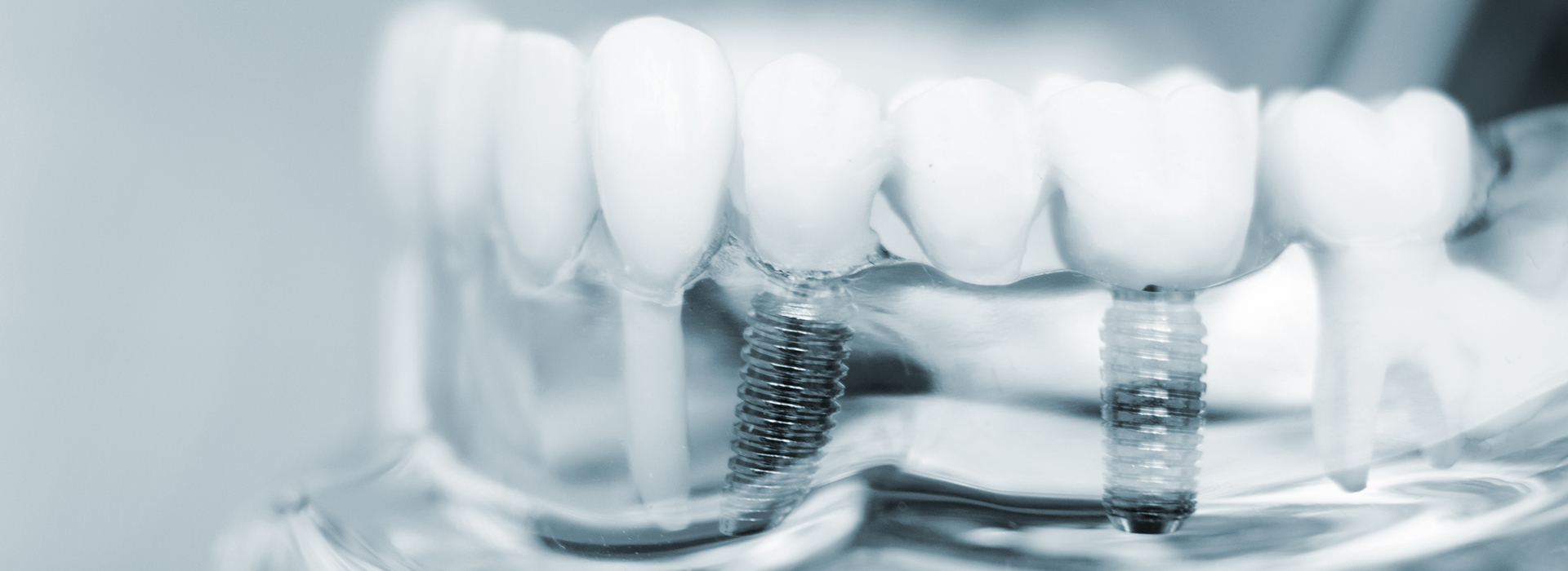 Lee Dental   Facial | Cosmetic Dentistry, Invisalign reg  and Dental Fillings